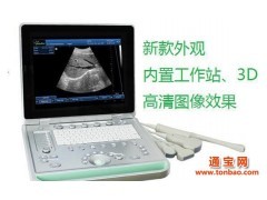 兽用全数字B超机 黑白动物妊娠医疗超声显像诊断 宠物医院B超_供应产品_广州索诺星信息科技(蔡伟忠)